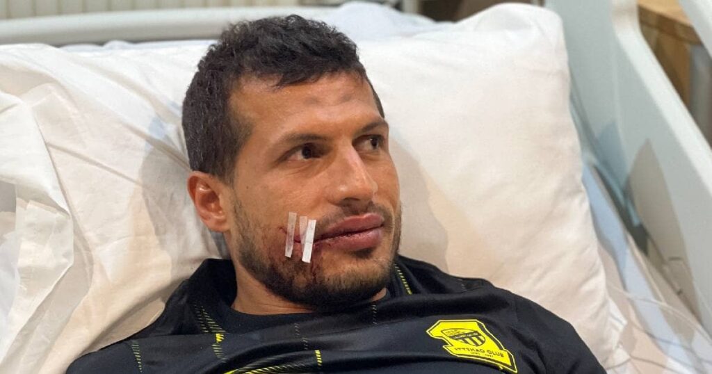 طارق حامد يجري حراحة في الوجه